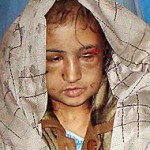 Jawed Basharat/Associated Press, Sahar Gul was taken to a hospital on Wednesday in Baghlan Province, north of Kabul.
